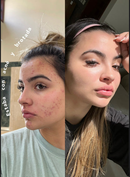 RENÖVA+ | Tu dosis Diaria de Juventud y Vitalidad